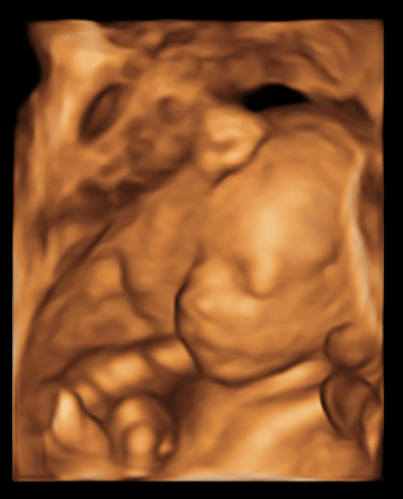 Pijn – Deel&nbsp;II