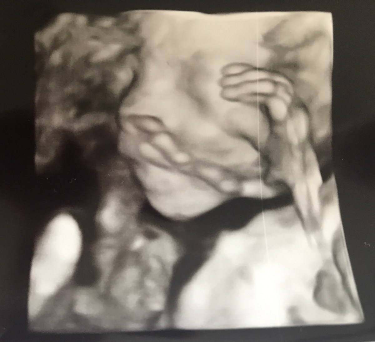 Pijn – Deel&nbsp;III